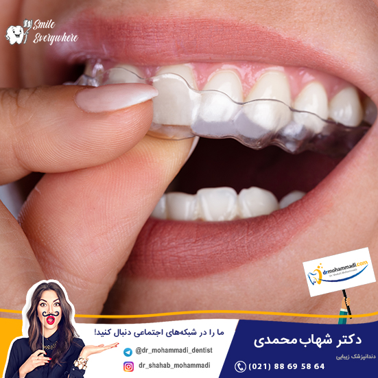 نایت گارد
